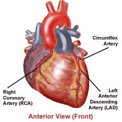 Heart Attacks - Heart of Georgia Cardiology