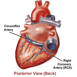 Heart Attacks - Heart of Georgia Cardiology